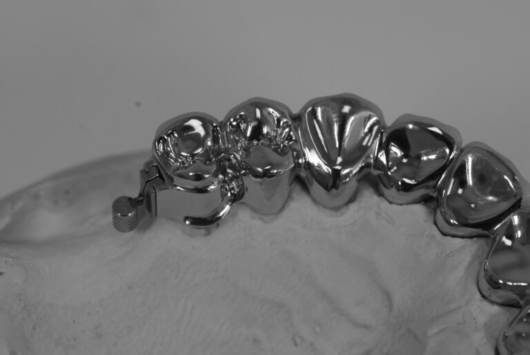 geschiebearbeit dsf unterfoto