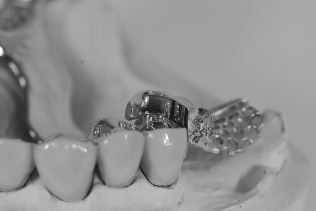 geschiebearbeit dsf unterfoto (1)