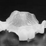 interimsprothese flex & smile gr