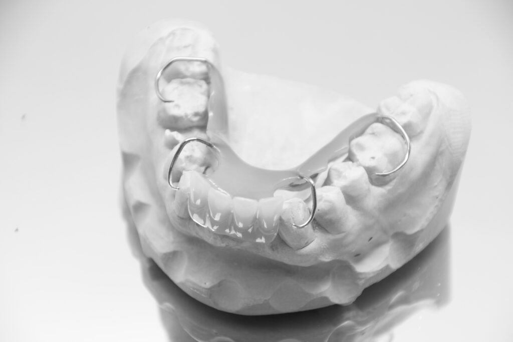 interimsprothese mit halteelemen