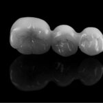 krone zirkon canva 1