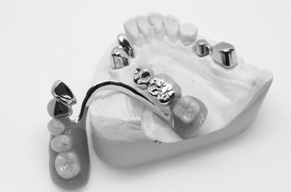 teleskoparbeit dsf 1